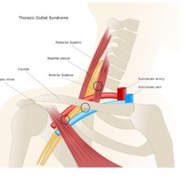 Thoracic outlet